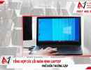 Tổng hợp các lỗi màn hình laptop phổ biến thường gặp 